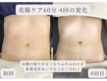 エイル(Eir.)/【腸もみ】before/after