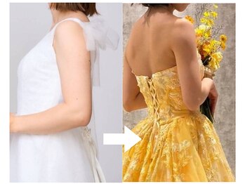 ビーエムビー(BMB)の写真/小顔と背中や二の腕、デコルテケアで理想のドレス姿を叶えるブライダル体験を!
