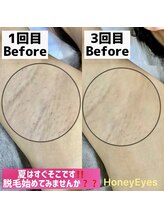 ハニーアイズ(Honey Eyes)/脇ワックス脱毛
