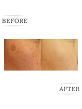 ココ(COCO)/お客様ビフォーアフター