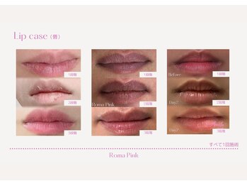 リシェリ 代官山(RICHERI)/ローマピンク唇1回の症例