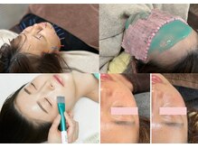 陽月 鍼灸院整骨院の雰囲気（美容鍼や剥離しないピーリングで肌の土台から整える）