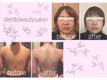 ヨサパーク シナモン 広尾店(YOSA PARK Cinnamon)の雰囲気（プロジェクター・アメニティー・生理用品完備！広尾駅徒歩5分！）