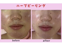 サロン ほほえむ(Fofo-m)/