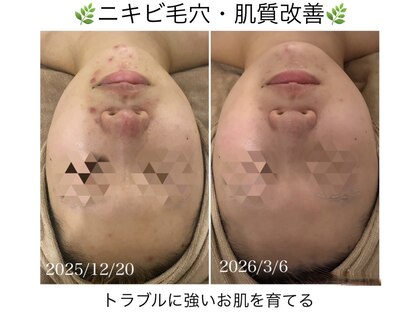 ソフ(soph.)の写真