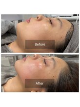 ドクターエイチ 麻布十番店(Doctor.H)/