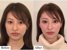 コルミチョン サロン(骨美整 salon)