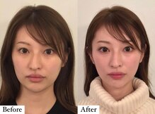 コルミチョン サロン(骨美整 salon)