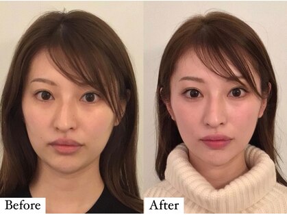 コルミチョン サロン(骨美整 salon)の写真