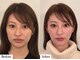 コルミチョン サロン(骨美整 salon)の写真