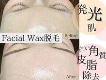 テテ(TeTe)の雰囲気（フェイシャルWAX脱毛で艶玉美人♪HBLとの同時施術がオススメ！）