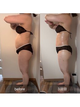 フィエルテ 甲斐敷島(FIERTE)/お客様 Before After