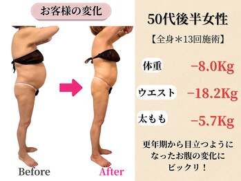 ベルホワイト(Belle White)/【50代後半/3ヶ月】