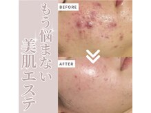 ニーナ ホワイトニングルーム(217whitening room)