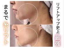 小顔マシン最新★DTの取れない方におすすめ♪