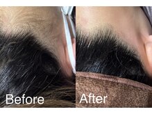 ディアーム 岸和田カンカン店(Diarm)/光脱毛でスッキリ☆