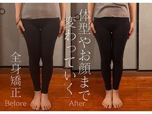 ロータス(LOTUS)/脚のライン激変！全身矯正で美脚