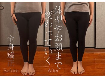 ロータス(LOTUS)/脚のライン激変!全身矯正で美脚