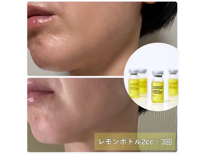 トータルビューティサロン リボーテ(Re:Beaute)の写真