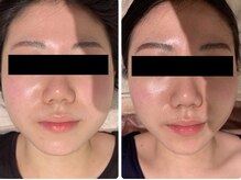 ルナグランデ(Luna grande.)/どんどん小顔に♪