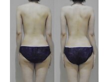 アルマ 芦屋(ALMA)/怠い首や肩、重い腰もシュッ！