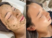 メメピュア 豊中(me me pure)の雰囲気（SNSで話題！REVIハーブピーリング毛穴.ニキビ.首のシワ改善に◎）
