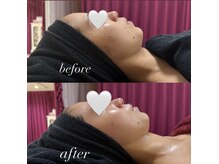 マヤヒメ(mayahime)/毛穴！小顔！美肌