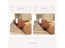リアンドボーテ(Lien de Beaute)の雰囲気（小顔ケアでフェイスラインがスッキリ☆）