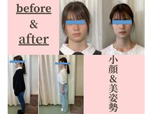 やえざきカイロプラクティックの雰囲気（ ★平塚駅西口徒歩2分！ 小顔＆骨盤・姿勢整体専門院！）