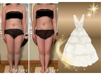 チャーム(Charm)/痩身初回80分