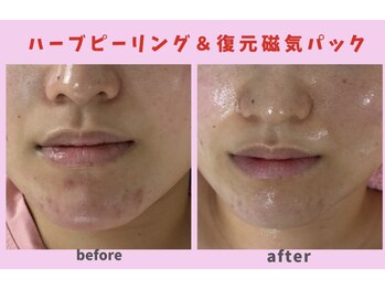 サロン ほほえむ(Fofo-m)/