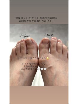 foot care spa