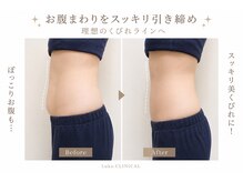 ルカクリニカル(Luka.CLINICAL)の雰囲気（お腹スッキリ応援♪今なら5回コースEMS付で1回8500円★）