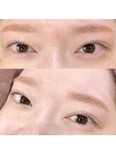 イヴ(Eve)/施術担当　CHIHIRO