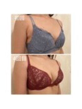 美人バスト 表参道店/【バストアップ/育乳 症例】