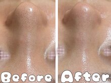 グラシア 倉敷店(Gracia)/お顔の症例事例