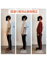 こころプラス整骨院/肩こり・猫背矯正
