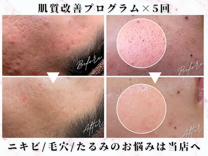 オレンジ(Orange)の写真