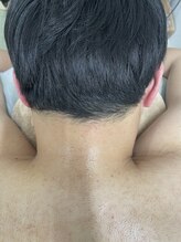 ナノハナ/鹿沼市の全身脱毛のナノハナ