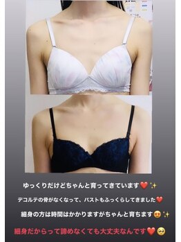 レアティ(Leathy)/細身の方もバストアップ出来ます