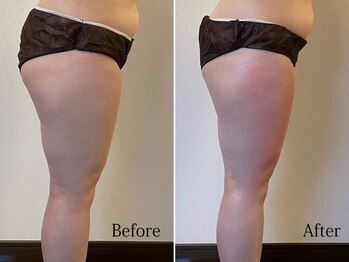 ライトウェーブ 松本村井本店/ももが細く、小尻になり高さが！