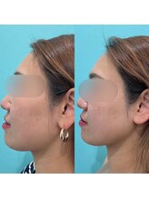 カンナムビューティー/オンダリフト/表参道/ララピール