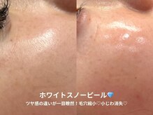 ピブ(pib.)/ホワイトスノーピール