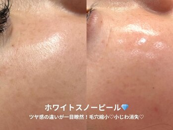 ピブ(pib.)/ホワイトスノーピール