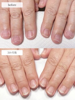 ディグニティ(Dignity)/薄い爪・弱い爪ケアパラジェル