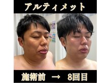 リリーローズ(LilyRose)の雰囲気（積み重ねで変わる顔つき。別格【グレードアップアルティメット】）