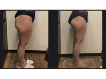 フェアリー(Fairy)/【痩身／美脚集中】