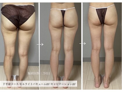 エヌボーテ(N. beaute)の写真