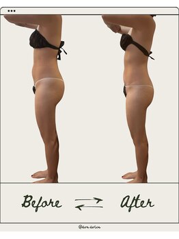 ドゥ ドルチェ(Due dolce)/前もものハリもスッキリ　1回