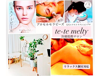 テテメルティ(te-te melty)の写真